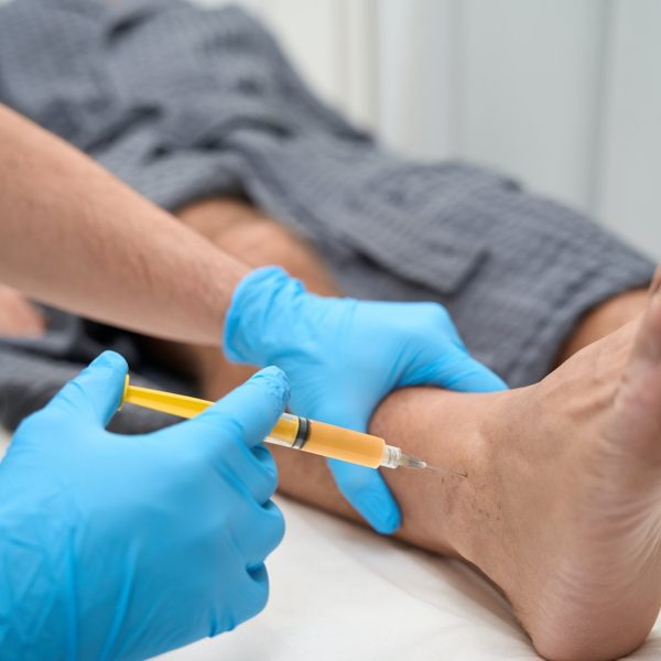 Medical specialist collecting a biopsy sample with a needle