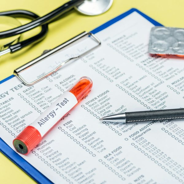 test tube and pen on allergy test results near stethoscope on yellow