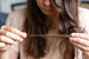 Young woman has hair loss problem. Loosing hair after covid disease. Care shampoo for repairing thin